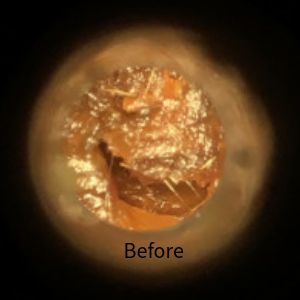 Before Ear Wax Removal picture 1